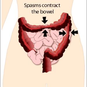 Ibs Diet Plan Constipation - How Is Irritable Bowel Syndrome Diagnosed?